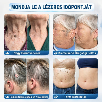 ✅🌱𝐇𝐢𝐯𝐚𝐭𝐚𝐥𝐨𝐬 𝐦á𝐫𝐤𝐚𝐛𝐨𝐥𝐭  𝐏𝐢𝐜𝐝𝐨®   𝟕 𝐍𝐚𝐩𝐨𝐬 𝐁ő𝐫𝐤𝐢𝐧ö𝐯é𝐬- é𝐬 𝐅𝐨𝐥𝐭𝐫𝐚𝐝í𝐫(Fájdalommentes, nyommentes roll-on)
