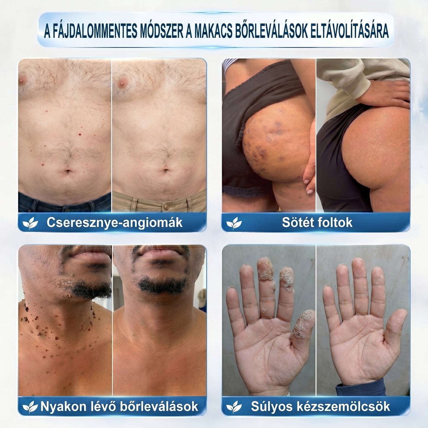 ✅🌱𝐇𝐢𝐯𝐚𝐭𝐚𝐥𝐨𝐬 𝐦á𝐫𝐤𝐚𝐛𝐨𝐥𝐭  𝐏𝐢𝐜𝐝𝐨®   𝟕 𝐍𝐚𝐩𝐨𝐬 𝐁ő𝐫𝐤𝐢𝐧ö𝐯é𝐬- é𝐬 𝐅𝐨𝐥𝐭𝐫𝐚𝐝í𝐫(Fájdalommentes, nyommentes roll-on)
