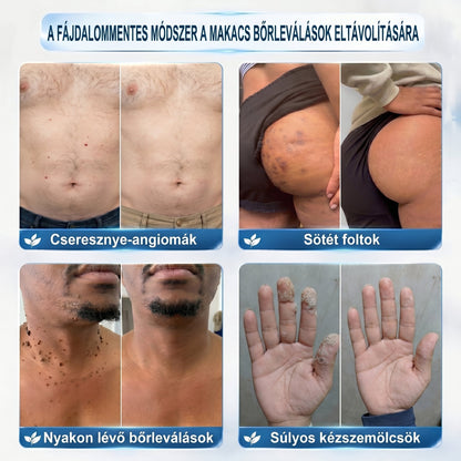 ✅🌱𝐇𝐢𝐯𝐚𝐭𝐚𝐥𝐨𝐬 𝐦á𝐫𝐤𝐚𝐛𝐨𝐥𝐭  𝐏𝐢𝐜𝐝𝐨®   𝟕 𝐍𝐚𝐩𝐨𝐬 𝐁ő𝐫𝐤𝐢𝐧ö𝐯é𝐬- é𝐬 𝐅𝐨𝐥𝐭𝐫𝐚𝐝í𝐫(Fájdalommentes, nyommentes roll-on)