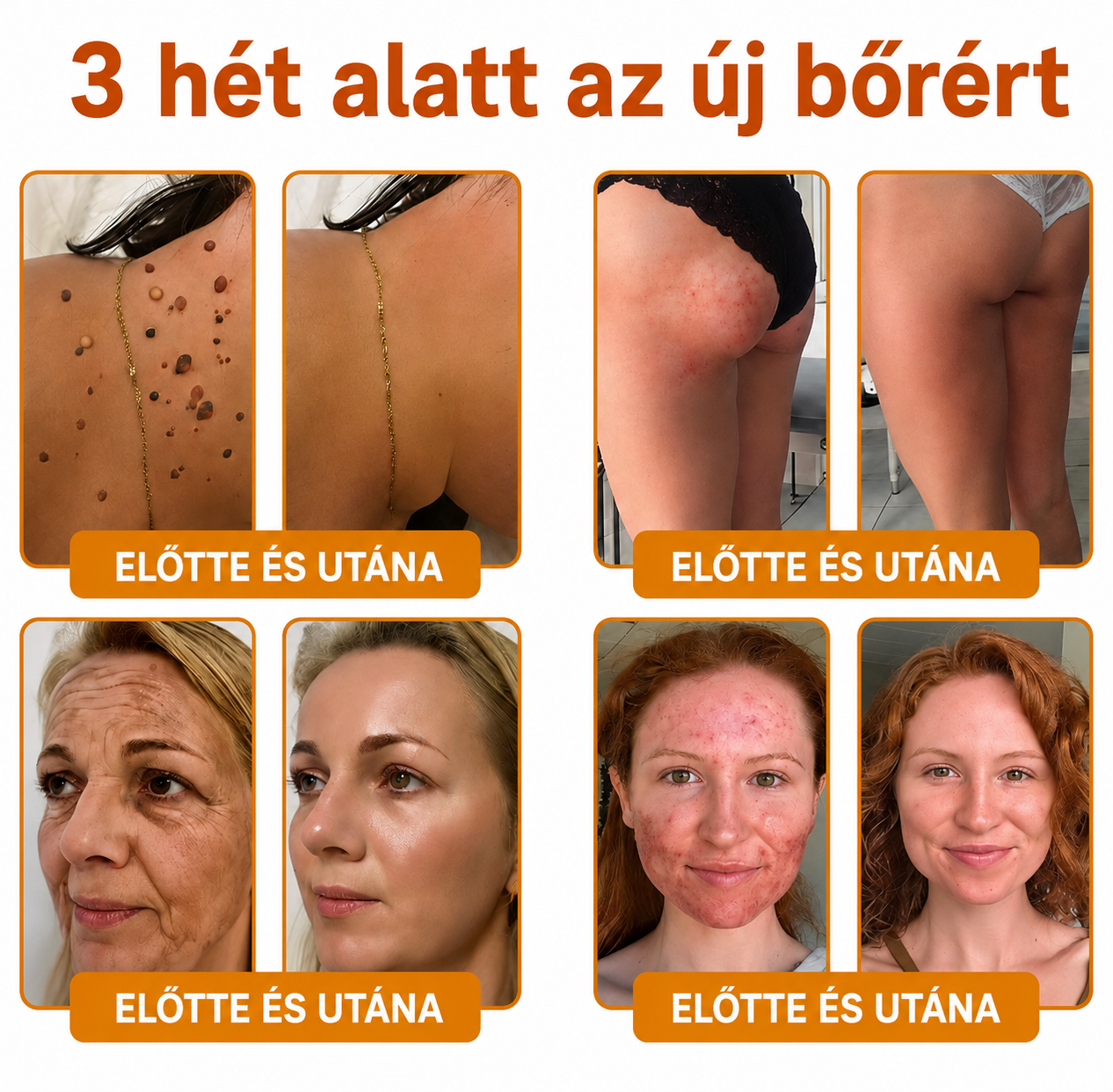 🔥🔥 𝐎𝐟𝐢𝐜𝐢á𝐥𝐢𝐬 á𝐫𝐮𝐡á𝐳 • 𝐊é𝐬𝐳ü𝐥𝐭 𝐚 𝐂𝐬𝐞𝐡 𝐊ö𝐳𝐭á𝐫𝐬𝐚𝐬á𝐠𝐛𝐚𝐧 🌱 𝗗𝗼𝗿𝗺𝗼𝗿𝗻𝗮® 𝗠é𝗵𝗺é𝗿𝗲𝗴 𝗞𝗼𝗺𝗽𝗹𝗲𝘅 𝗞𝗿é𝗺 🌟 𝐔𝐓Ó𝐋𝐒Ó 𝐍𝐀𝐏 – 𝟖𝟎% 𝐊𝐄𝐃𝐕𝐄𝐙𝐌É𝐍𝐘