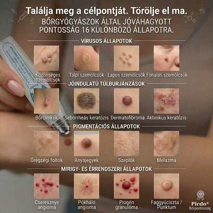 ✅🌱𝐇𝐢𝐯𝐚𝐭𝐚𝐥𝐨𝐬 𝐦á𝐫𝐤𝐚𝐛𝐨𝐥𝐭  𝐏𝐢𝐜𝐝𝐨®   𝟕 𝐍𝐚𝐩𝐨𝐬 𝐁ő𝐫𝐤𝐢𝐧ö𝐯é𝐬- é𝐬 𝐅𝐨𝐥𝐭𝐫𝐚𝐝í𝐫(Fájdalommentes, nyommentes roll-on)
